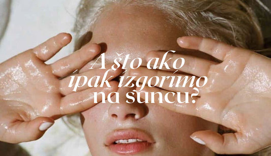 Što kad ipak izgorimo na suncu?