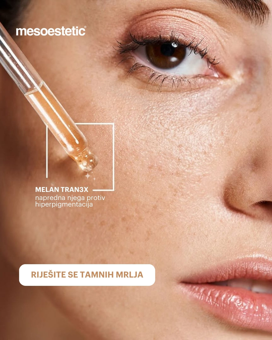 mesoestetic melan tran3X concentrate
