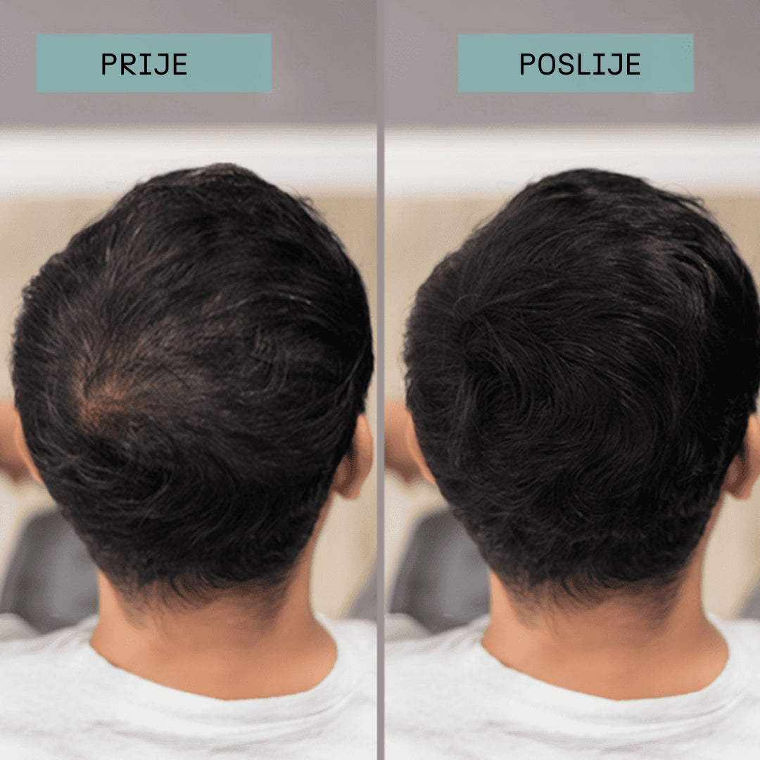 Keratin fibers- Keratin vlakna za kosu
