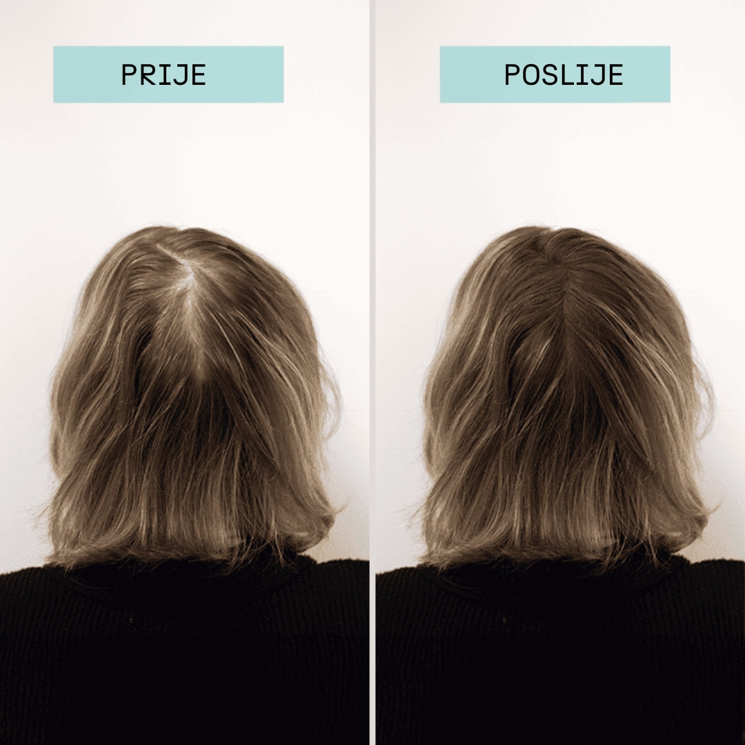 Keratin fibers- Keratin vlakna za kosu
