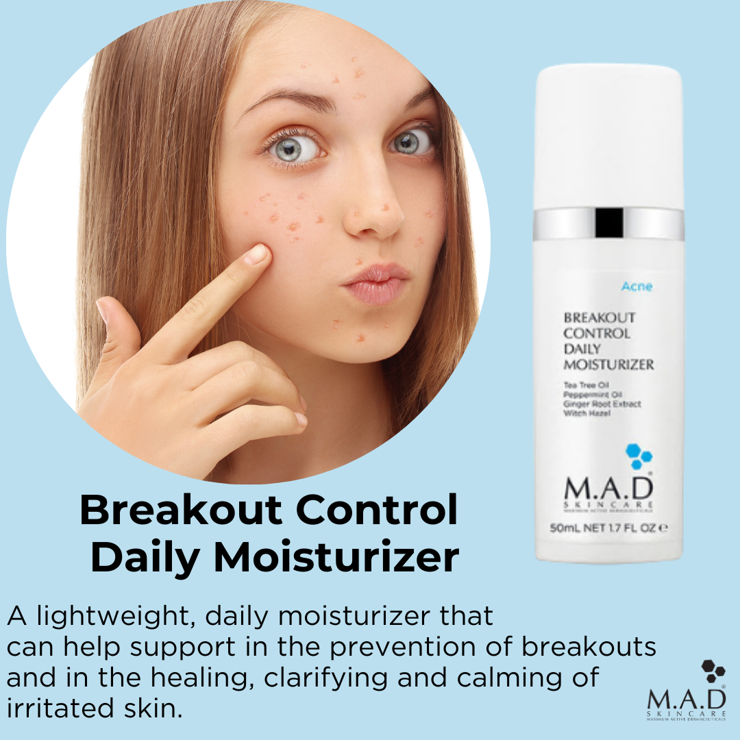 M.A.D Breakout Control Daily Moisturizer